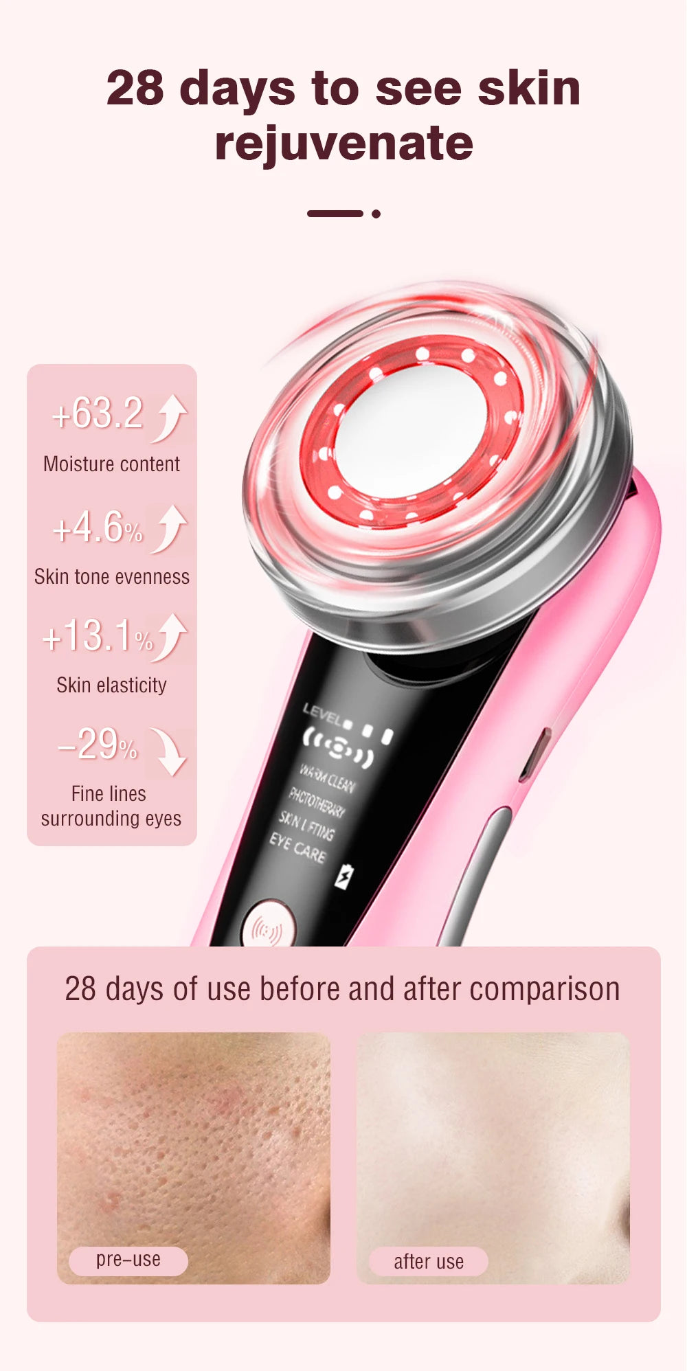 EMS RF Skin-Tightening & Face-Lifting Device Microcurrent Red-Light Massage for Skin Rejuvenation & Glow
